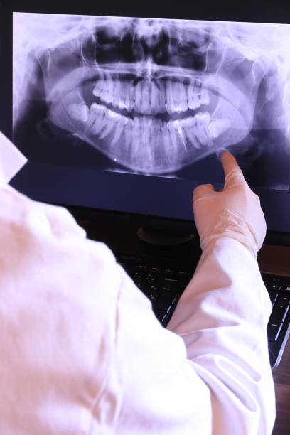 Best Same-Day Emergency Dentist in Olga, FL