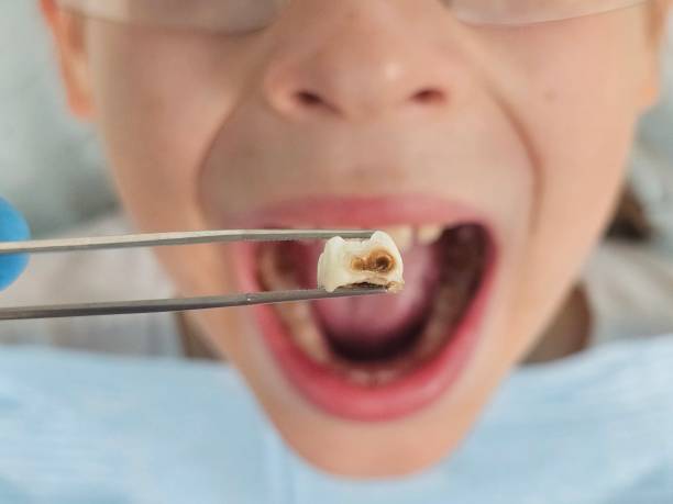 Best Weekend Emergency Dentist in Olga, FL