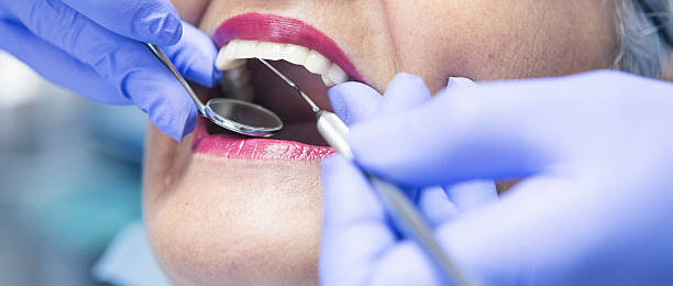 Best Emergency Tooth Extraction in Olga, FL